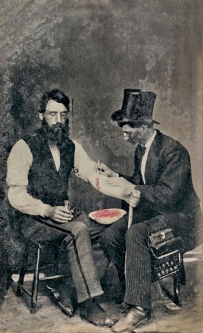 Sangria em 1860, uma das 3 únicas fotografias conhecidas do procedimento – Foto da wikipedia