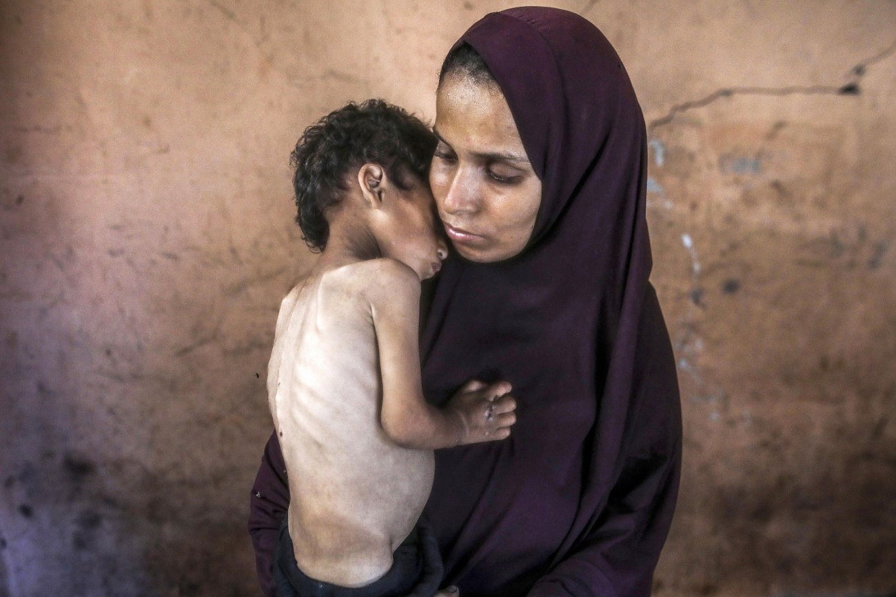 Yazan Abu Foul, de dois anos, que sofre de desnutrição grave, é segurado pela mãe no campo de refugiados de Al-Shati, na parte ocidental da cidade de Gaza, em 19 de julho de 2025. (Yousef Zaanoun/Activestills)