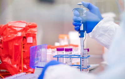 Vacina para o covid-19, "no melhor dos cenários, apenas no próximo ano estará pronta" Foto creative commons