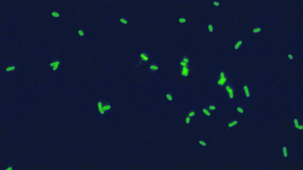 Legionella pneumophila - Foto wikimedia