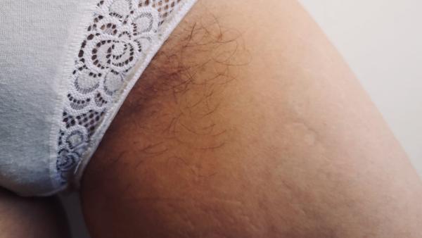 Depilação: uma construção patriarcal do “feminino”