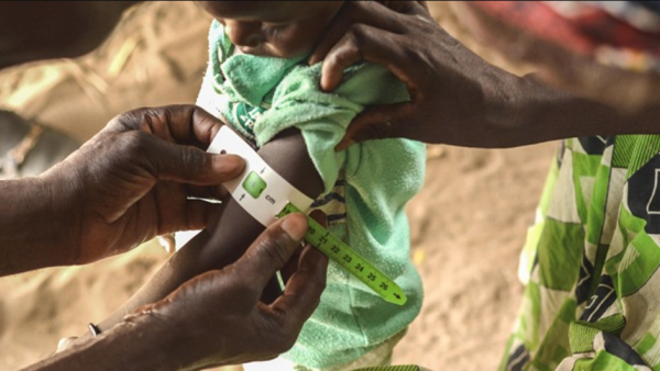 Um membro dos Médicos sem Fronteiras mede o perímetro braquial de uma criança. Foto de Elise Mertens, via msf.org.