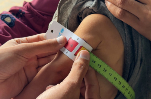 Iman, de seis anos, é testado por causa da mal-nutrição. Cidade de Gaza, no centro médico da UNRWA.