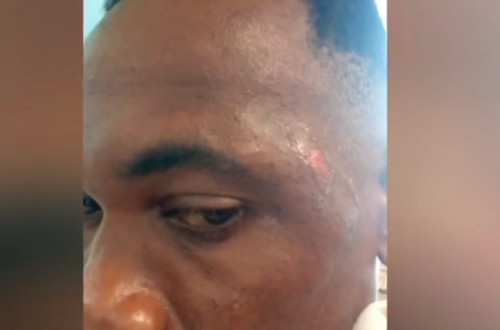 Marcas das agressões