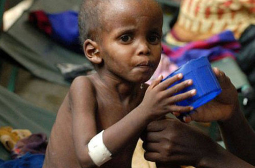 "A violência, a fome e a sede forçam as pessoas a deslocarem-se o que agrava a situação de fome", afirma Manuel Fontaine. Foto África 21 