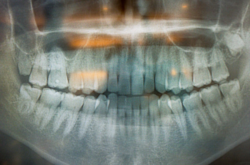 Radiografia dentária. Foto de Dick Thomas Johnson/Flickr.