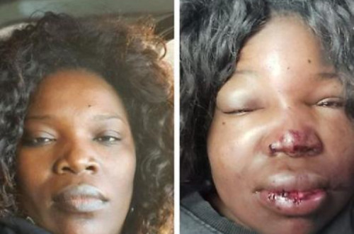 Fotografias de Cláudia Simões antes e depois das agressões da Polícia de Segurança Pública.