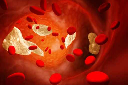 O estudo é considerado um avanço científico significativo para a problemática das doenças cardiovasculares. Imagem FH Foundation