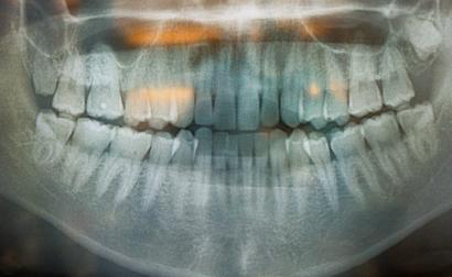Radiografia dentária. Foto de Dick Thomas Johnson/Flickr.