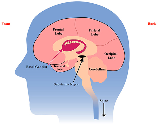 Cérebro Parkinson